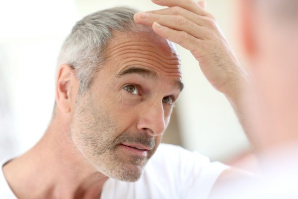 What You Need to Know About Hair Loss and Thinning Hair